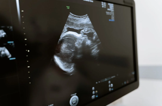 SC Supreme Court Upholds Six-Week Abortion Ban